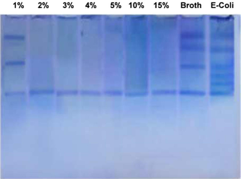 Photograph and diagrammatic illustration of electrophoretic protein pattern of E. coli and E. coli inoculated with different concentrations of Lawsonia inermis.