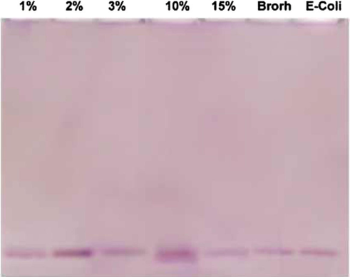 Photograph and diagrammatic illustration of electrophoretic glycoprotein pattern of E. coli and E. coli inoculated with different concentrations of Lawsonia inermis.