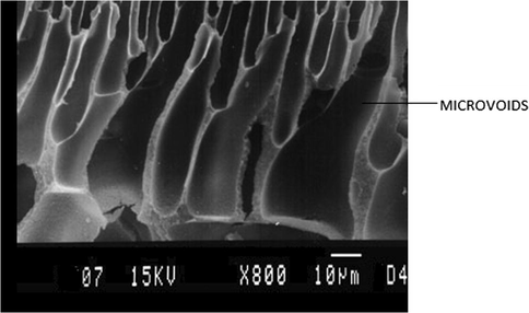 SEM cross section image of the membrane M1.