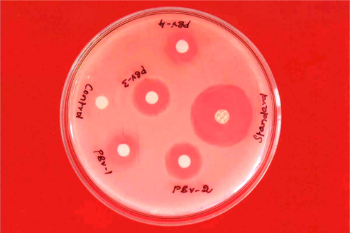 Antibacterial activity against E. coli (1 mg/ml). The zone of inhibition in mm for the test compounds PBV-1 to PBV-4 at the concentration 1 mg/ml against E. coli was found to be 12, 15, 14 and 11, respectively.