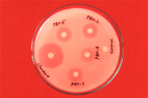 Antibacterial activity against E. coli (1 mg/ml). The zone of inhibition in mm for the test compounds PBV-5 to PBV-8 at the concentration 1 mg/ml against E. coli was found to be 16, 15, 13 and 11, respectively.