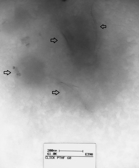 TEM image of organophile nanocomposite PTHF–Mmt with C4H4O4 (1 N).