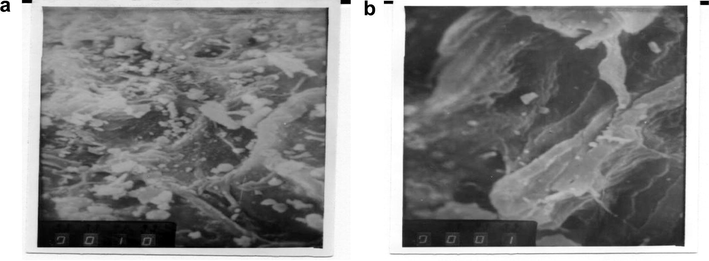 Scanning electron microscope of OS6 (a) and OS7 (b).