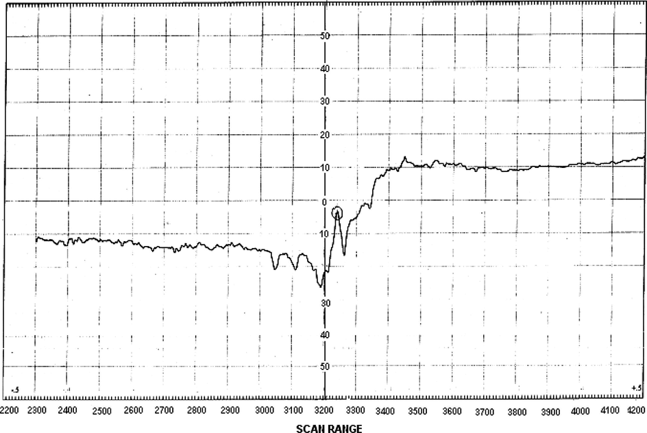 ESR spectrum of [VO(sal-sdz)(H2O)]·H2O (1).