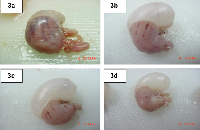 Macroscopical appearance of gastric mucosa in rats. (a) Rats pre-treated with 10% Tween 20. Severe macroscopic necrosis of gastric mucosa. Absolute ethanol produced extensive visible hemorrhagic necrosis of gastric mucosa. (b) Rats pre-treated with cimetidine 50 mg kg−1). Mild macroscopic necrosis of gastric mucosa. The drug reduces the formation of gastric lesions induced by absolute ethanol. (c) Rats pre-treated with Zn(BzSO–HAP) (50 mg kg−1). Mild macroscopic necrosis of gastric mucosa. The compound reduces the formation of gastric lesions induced by absolute ethanol. (d) Rats pre-treated with Zn(BzSO–HAP) (100 mg kg−1). The compound prevents the formation of gastric lesions induced by absolute ethanol.