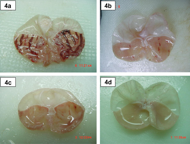 Macroscopical appearance of gastric mucosa in rats in open stomach. (a) Rats pre-treated with 10% Tween 20. Severe macroscopic necrosis of gastric mucosa. Absolute ethanol produced extensive visible hemorrhagic necrosis of gastric mucosa. (b) Rats pre-treated with cimetidine 50 mg kg−1). Mild macroscopic necrosis of gastric mucosa. The drug reduces the formation of gastric lesions induced by absolute ethanol. (c) Rats pre-treated with Zn(BzSO–HAP) (50 mg kg−1). Mild macroscopic necrosis of gastric mucosa. The compound reduces the formation of gastric lesions induced by absolute ethanol. (d) Rats pre-treated with Zn(BzSO–HAP) (100 mg kg−1). The compound prevents the formation of gastric lesions induced by absolute ethanol.