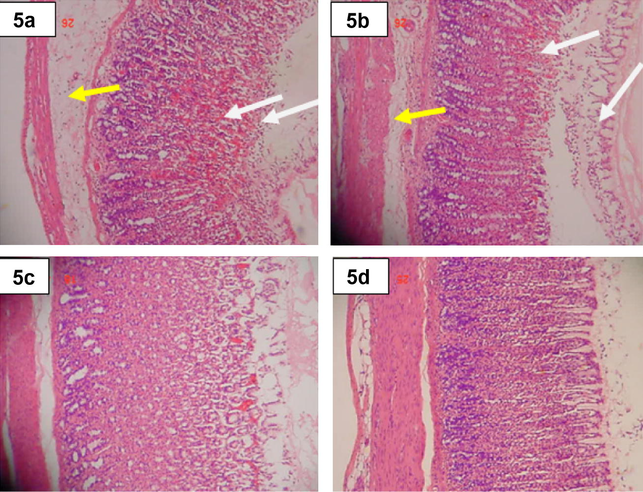 Histological section of the absolute ethanol-induced gastric mucosal damage in rats. (5a) Rats pre-treated with 10% Tween 20 (ulcer control). Severe disruption of the surface epithelium, deep penetration of necrotic lesions into mucosa (arrow) and edema of the sub mucosa layer (yellow arrow) with leukocyte infiltration of ulcerative tissues. (b) Rats pre-treated with cimetidine (50 mg/kg). Moderate disruption of the surface epithelium and edema of the sub mucosal layer (yellow arrow) with leucocytes infiltration. (c) Rats pre-treated with Zn(BzSO–HAP) (50 mg kg−1). There is mild disruption of the surface epithelium. (d). Rats pre-treated with Zn(BzSO–HAP) (100 mg kg−1. No disruption to the surface epithelium (arrow) and no edema and leucocytes infiltration of sub mucosal layer (H&E stain, 10×).