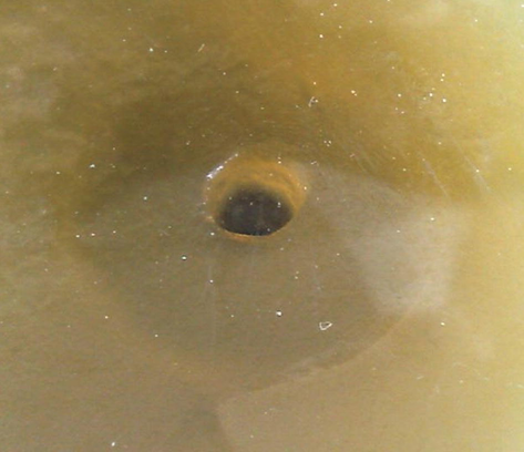 Zone of inhibition of ethyl acetate extract against Staphylococcus aureus.