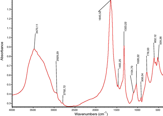 FTIR spectrum of urinary stone cross-core containing weddellite + carbapatite.