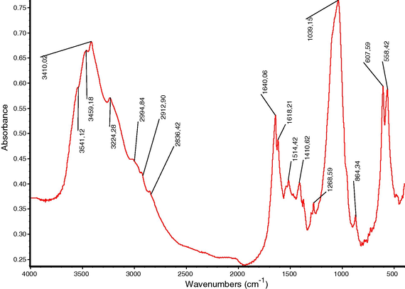 FTIR spectrum of urinary stone section containing weddellite + carbapatite + whewellite + protein.