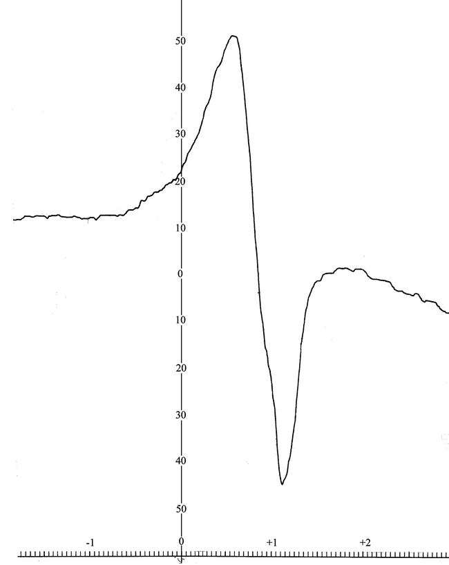 The EPR spectrum of Cu(II) complex.