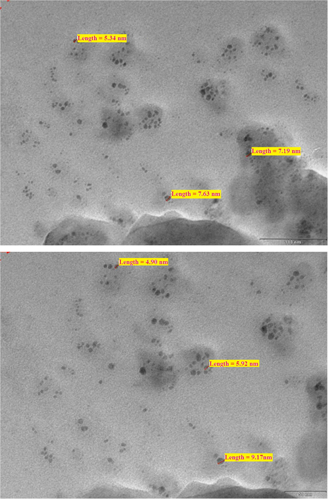 TEM micrographs of reactive nanohydrogel particle.