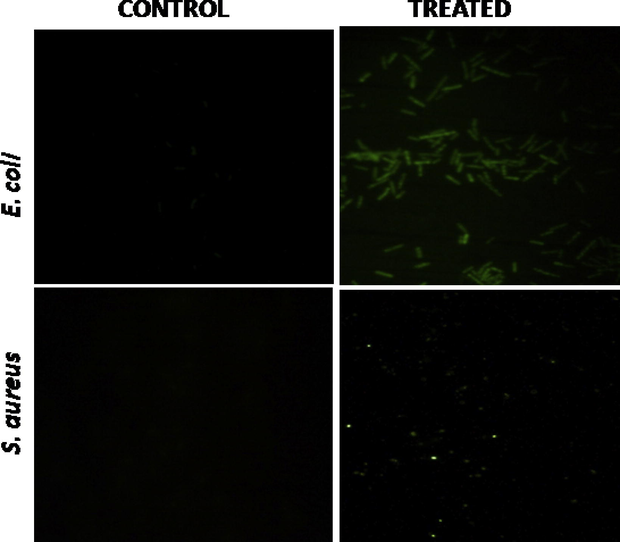 Micrographic image of intracellular ROS generation of Ag NPs in multidrug resistant E. coli and S. aureus strains.