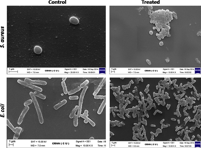 Action of Ag NPs on E. coli and S. aureus cells observed by SEM. A: E. coli Control; B: E. coli treated; C: S. aureus Control; D: S. aureus Treated.