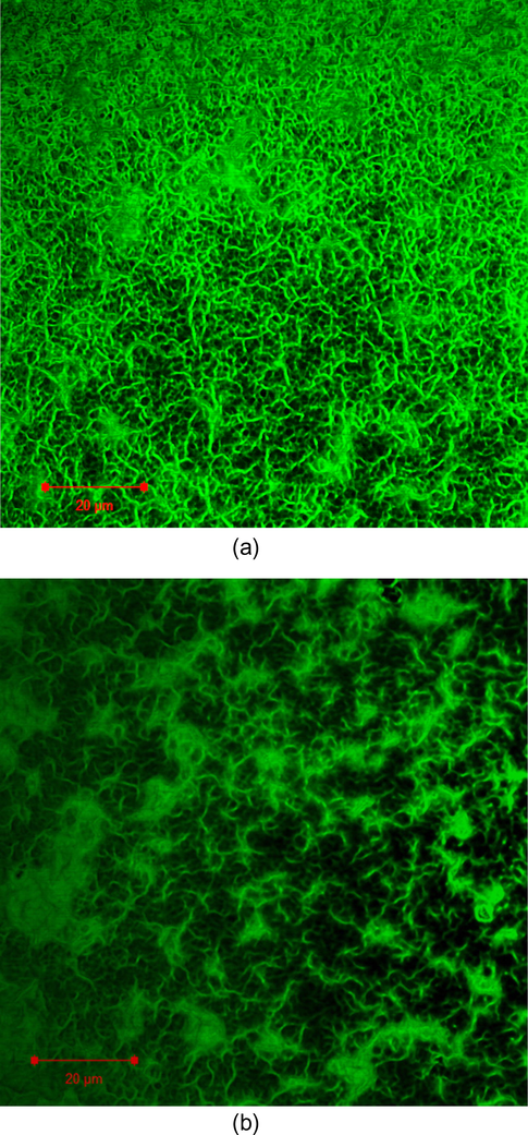 CLSM micrographs in situ hydrogels microstructures in (a) and (b). Green regions are fluorescently stained self-assembled nanofibers. Space bar 20 μm.