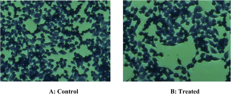 Inverted microscope images were illustrating the possible cytotoxic response of core/shell/SiO2 NCs on HT-29 cells through crystal violet staining. (A): No cytotoxicity was observed in control untreated HT29 cells. (B): Non-significant cytotoxic response was observed in HT29 exposed with highest (100 µg) concentrations of core/shell/SiO2 NCs. Although little alterations were observed in morphology and number of HT-29 cells.