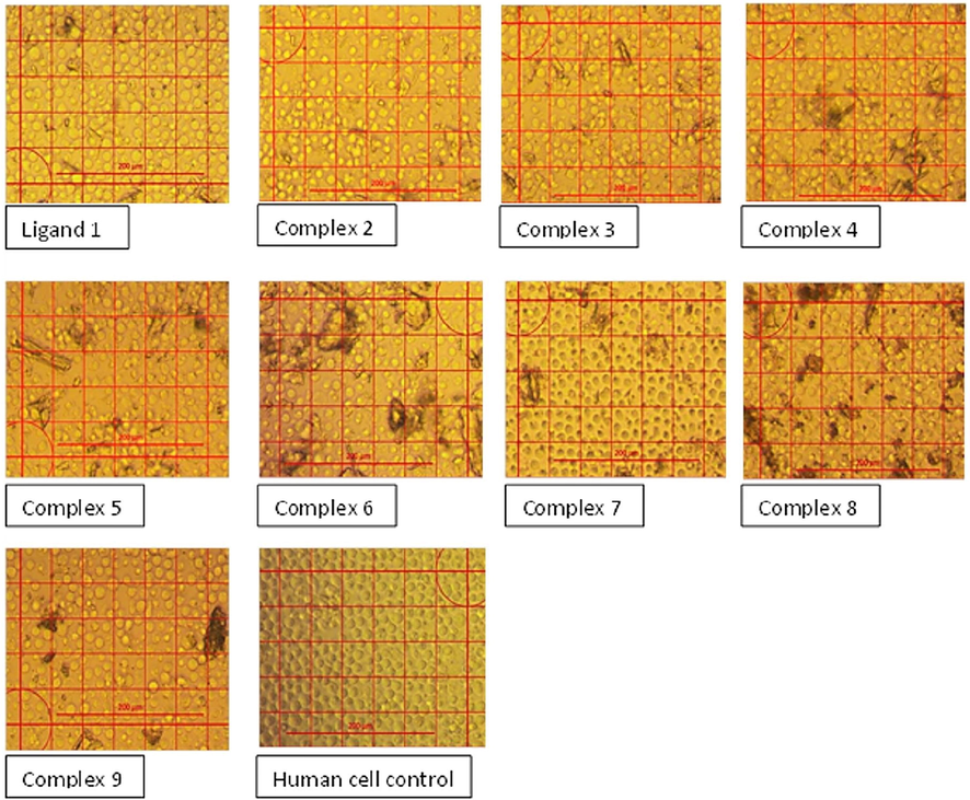 Inverted microscopic examination of the human mononuclear cells from peripheral blood treated with a concentration of 62.5 µg/mL of the ligand and the complex compounds.