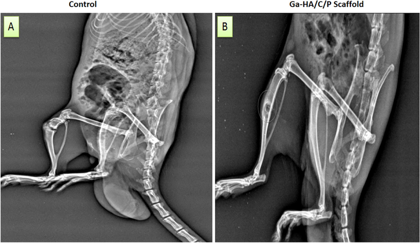 X-ray images of (A) the surgical rat without any treatment and (B) Ga-HA/C/P implanted rat after 4th week of implantation. The alteration in the curative of imperfection side between the control and implanted clusters with Ga-HA/C/P scaffold assemblages were further long-established by X-ray image analysis (Fig. 10 A and B). The automatically shaped blemish side did not restore even after 4th week in control but in the Ga-HA/C/P scaffold administration.