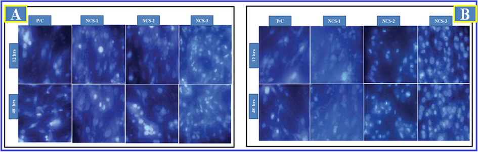 Cell attachment on nano-composites with different cell lines (A) NIH3T3 cells and (B) MG-63 cells. DAPI staining was displayed that the Ga-HA/C/P exposed cells were noticeably improved the propagation of NIH3T3 and MG-63 cells when compared to control.