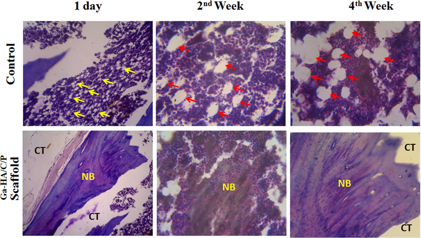 MT staining of experimented tissue without implantation (Control) and after implantation with Ga-HA/C/P scaffold after day 1, week 2 and week 4. Yellow arrow- Osteoids; red arrow- Osteoblast cells; CT- Connective tissues; NB- New bone. The MT staining displayed the establishment of new bone tissues over osteoblast difference as showed in Fig. 9. In control groups, the amount of osteoid and osteoblast cells is designated in yellow and red color projectiles correspondingly. After 1 day of establishment, the new bone foundation was minutes associated with other periods such as 2nd and 4th week of imbedding. After the 4th week, more influential blue color was perceived representing that the newly designed bone by osteoblast difference was improved by the Ga-HA/C/P scaffold grafting.