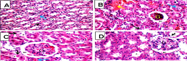 light photomicrograph (H&E X 400), A; (Cont gp): renal medulla showing average collecting tubules (CT) with average epithelial lining (black arrow) and average interstitium (blue arrow). B; (TAA gp): small-sized glomerulus (G) with widened Bowman’s space (BS), proximal tubules with edematous lining (black arrow) with intra- tubular debris (blue arrow), and areas of interstitial hemorrhage (yellow arrow). C; (Sil + TAA gp): showing congested edematous glomerulus (G), proximal tubules with edematous and apoptotic epithelial lining with partial loss of brush borders (black arrow), and congested blood vessels (blue arrow) D; (Eg + TAA gp) showing average glomerulus (G) with average Bowman’s spaces (BS), and few proximal tubules (P) showing partial loss brush borders (black arrow).