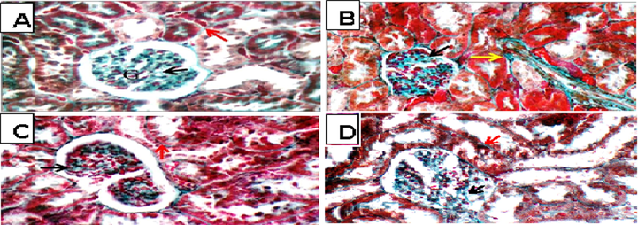 light photomicrograph (MT X 400), A; (Cont gp): average collagen distribution in glomeruli (black arrow) and around tubules (red arrow). B; (TAA gp): showing excess collagen in glomeruli (black arrow) and around tubules (yellow arrow). C; (Sil + TAA gp): showing average collagen distribution in glomeruli (black arrow) and around tubules (red arrow). D; (Eg + TAA gp): showing excess collagen in glomeruli (black arrow) and around tubules (red arrow).