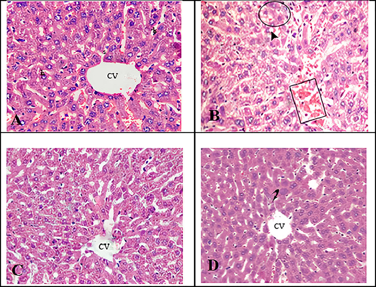 Micrographs of H&E stained liver sections of rats. (A) Control rats displaying normal histology. (B) Rats exposed to gold NPs exhibiting congestion of the central vein (square), cytoplasmic vacuolisation of hepatocytes (arrow head) and hepatic necrosis of foci along with inflammatory cell influx (circle). (C) Rats exposed to gold NPs and treated with I3C, demonstrating reduced congestion and fewer inflammatory cell population. (D). Rats treated only with I3C showing normal liver architecture. CV; central vein.