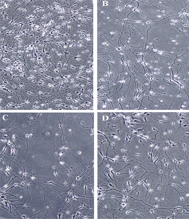 The morphological changes of spinal cord neurons as control (A), H2O2-treatd group (B), H2O2-induced group pretreated with quercetin (C), and H2O2-treated group pretreated with quercetin-HSA nano-complex (D). Quercetin-HSA nano-complex triggers a protective effect against H2O2-induced morphological changes on spinal cord neurons.