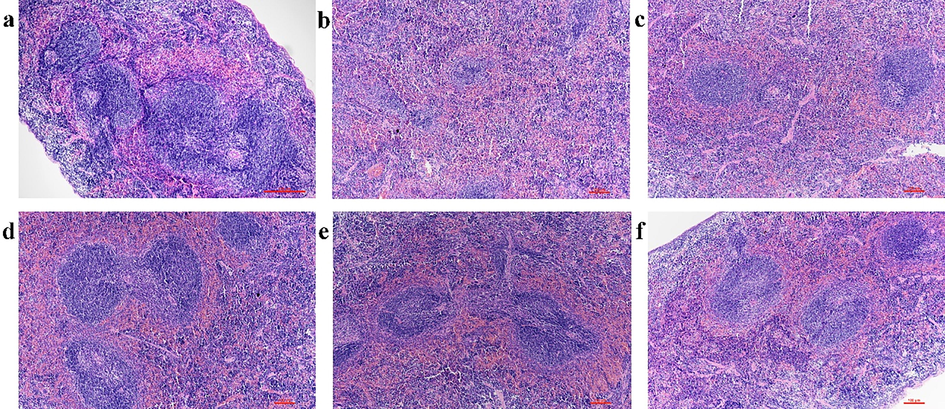 The effect of PEO nanoemulsion on HE staining of spleen in MGC-803 tumor-bearing nude mice (magnification × 100). a: Normal group; b: Model group; c: PTX group (10 mg·kg−1, twice a week); d: PEO-nano-L (50 mg·kg−1·d−1); e: PEO-nano-H (100 mg·kg−1·d−1); f: free-PEO (100 mg·kg−1·d−1).