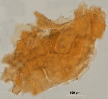 Images of the hydrogel under a microscope.