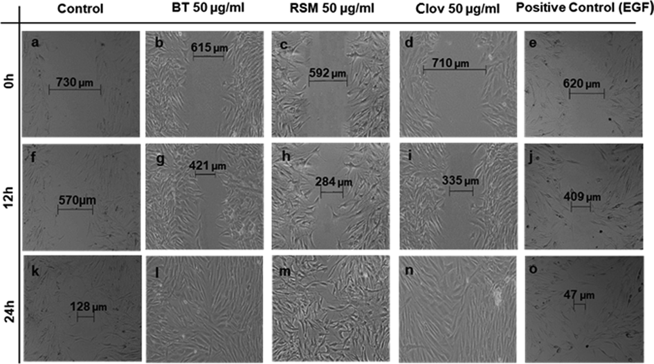 Effects of ghee samples on the migration of human fibroblasts. The extent of wound closure in scratch assays at doses of 50 μg/mL after 0, 12 and 24 h in comparison with positive and negative controls. Fibroblasts migrated until complete closure to fill the wound. BT: non-macerated ghee; RSM: Rosemary; Clov: Cloves.