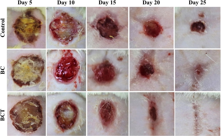 Representative images of burn wounds in control, BC, and BCT groups at days 5, 10, 5, 20, and 25 (Jiji et al., 2019).