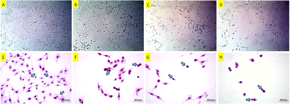 Inverted microscope images (A-D) of DU145 cells following copper(II) complex treatment. A: Untreated cells, B: 25 μM, C: 37 μM and D:50 μM, copper(II) complex-treated cells for 24 h. While there are mild degenerations in the low dose –treated cells in A, particularly the cells in C and D are damaged more. Hematoxylin-eosin staining (E-H) of DU145 cells following copper(II) complex treatment. E: Untreated DU145 cells. Arrows: Normal cells with gross cytoplasm and standard nuclei. F: 25 μM of copper(II) complex-treated DU145 cells. Arrows: Condensed cell and cell with membrane blebbing. G: 37 μM of copper(II) complex-treated DU145 cells. Arrows: Condensed and shrunken cells. H: 50 μM of copper(II) complex-treated DU145 cells. Arrows: Condensed and shrunken cells.