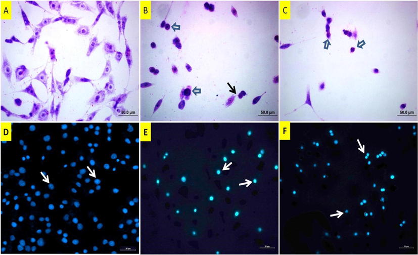 May Grunwald images (A-C) of DU145 cells following copper(II) complex treatment. A: Untreated cells, B: 37 µM and C: 50 µM of copper(II) complex-treated cells for 24 h. White arrow: Shrunken and rounded cells with condensed nuclei, black arrow: Membrane blebbing. DAPI staining (D-F) of DU145 cells. D: Untreated cells, arrows: normal size nuclei. E: 37 µM of copper(II) complex-treated cells, arrows: Pyknotic nuclei. F: 50 µM of copper(II) complex-treated cells, arrows: Pyknotic nuclei.