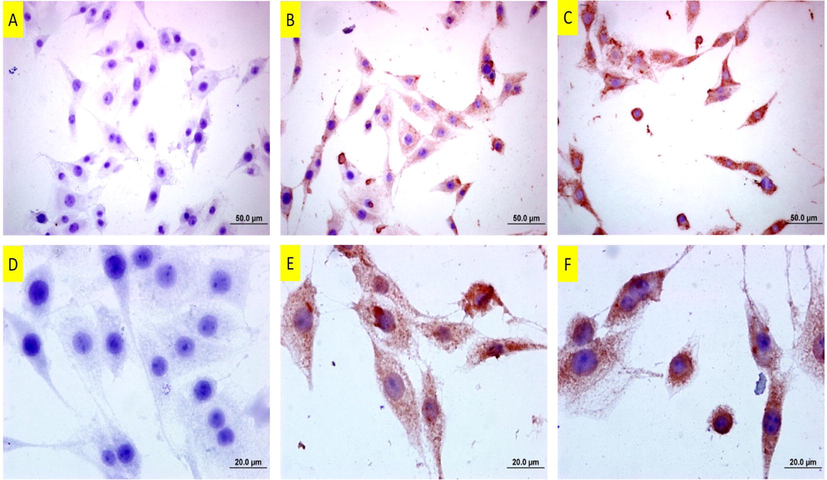 Bax staining of DU145 cells following copper(II) complex treatment. A: Untreated cells. Note of almost no positive staining B: 25 µM and C: 37 µM of copper(II) complex-treated cells for 24 h. Note that the cells are immune-positive and the intensity of staining is even more at the higher dose. The bars in A, B and C indicate 50 µm and bars in D, E and F indicate 20 µm.