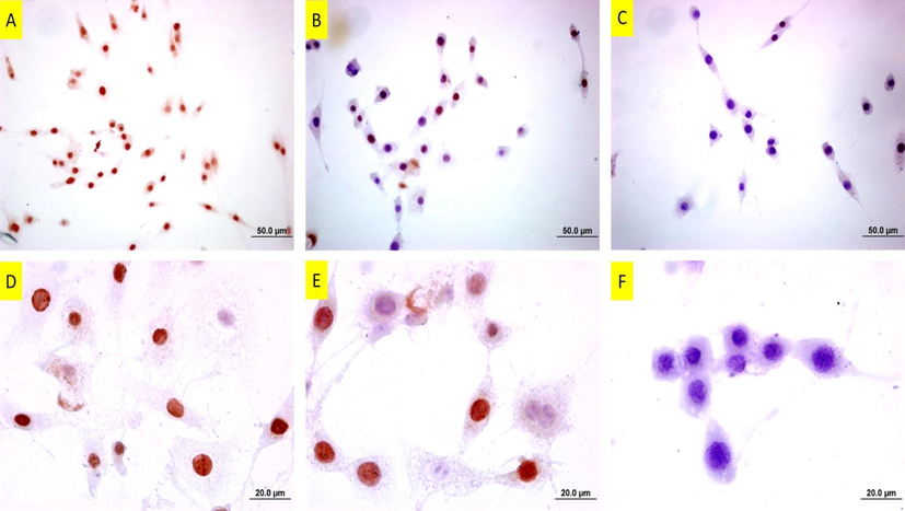 PCNA staining of DU145 cells following copper(II) complex treatment. A: Untreated cells. Note of the number of intensely-stained cells B: 25 µM and C: 37 µM of copper(II) complex-treated cells for 24 h. Note that the stained cells decreased at the dose of 25 µM, and there are barely stained cells at the dose of 37 µM. The bars in A, B and C indicate 50 µm and bars in D, E and F indicate 20 µm.