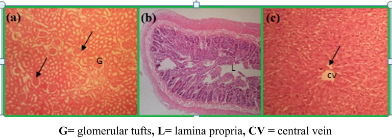 Microscopic images of tissues of rats taken after oral doses of PtNPs at 5 and 10 µg/g/day for one week: Glomerular in kidney (a) no changes observed in the intestine (b) and hepatocytes in liver.