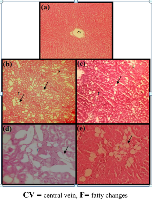 Liver damage comparison in normal control and CCl4 induction single dose 3 ml/kg subcutaneous (s.c), (a) liver of normal rat (b, c) CCl4 control × 100, (d, e) CCl4 control × 200 showing fatty cytoplasmic vacuolation of entrilobularhepatocytes. (H & E) × 100.