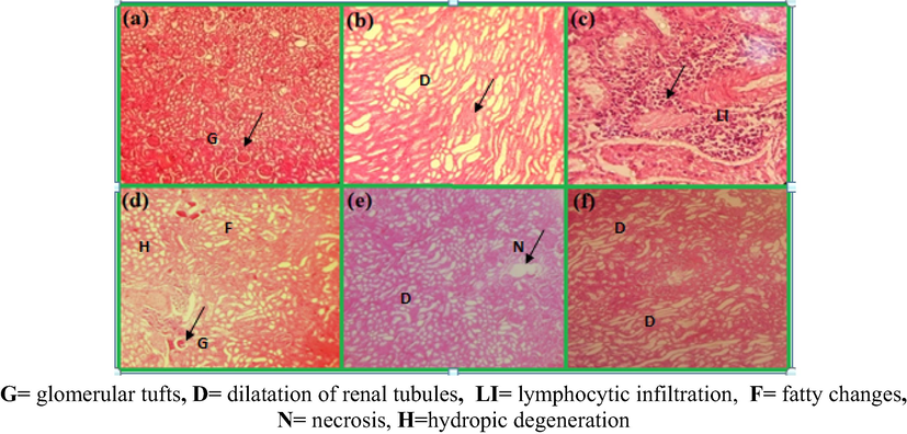 Comparison of kidneys of rats after 3 weeks of oral doses of Pt NPs and AAE, (a) kidney of normal rats (no change), (b) CCl4 control × 100, (Sever cytoplasmic fatty vaculation and dilatation of renal tubules in cortex), (c) represents CCl4 control × 200, (severe lymphacytic infiltration),(d) 0.78 g/kg AAE- (cytoplasmic fatty vacuolation change), (e) 1.56 g/kg AAE, (f) PtNPs (high dose degeneration of glomeruli and dilatation of renal tubules in cortex) (H & E) × 100.