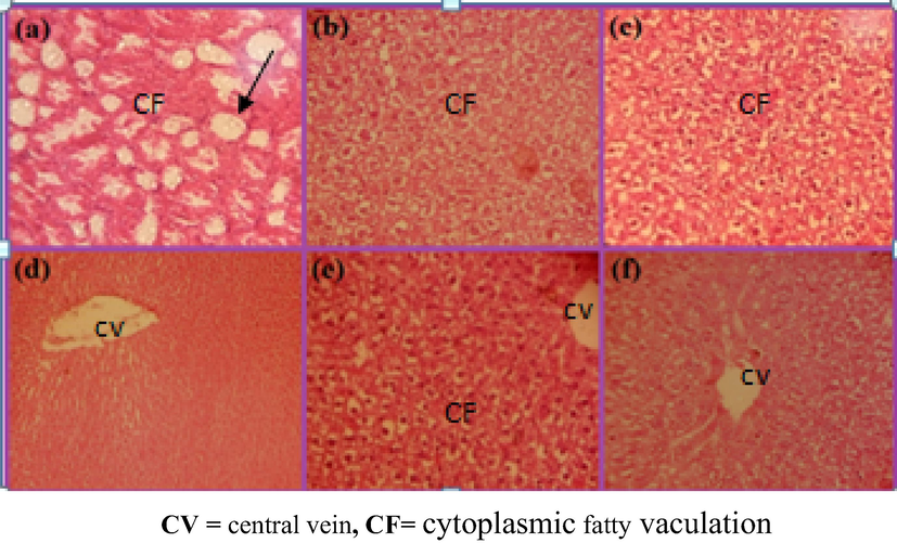 Liver images of rats received a daily oral low dose of AAE (0.78 g/kg) for 7 days and CCl4induced on 7th day showing, Cytoplasmic fatty vaculation(a, b, c) and high dose (1.56 g/kg) for 21 days and CCl4 on 7th day showing less cytoplasmic fatty vaculation(d, e, f) (H & E) × 100.