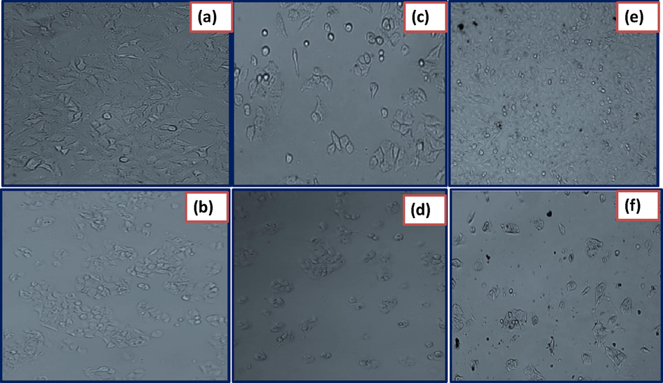 Photographs on cytotoxicity studies against cancer cell lines such as A549 (a) HepG2 (b) control-cell untreated. A549 (c) HepG2 (d) cell lines treated with standard drug Cisplatin and A549 (e) HepG2 (f) Cells treated with biosynthesized NiO NPs.