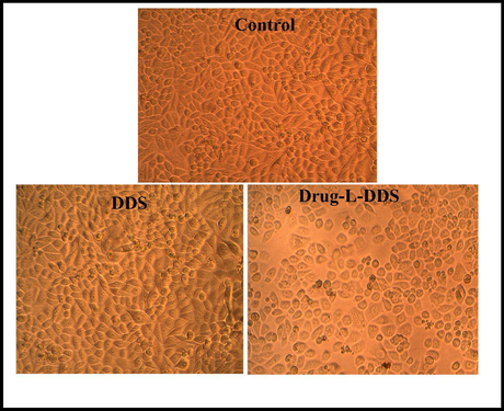 Morphological images of DLD1 cell line treated with 6.25 µg/mL of DDS, Drug-L-DDS and Control.