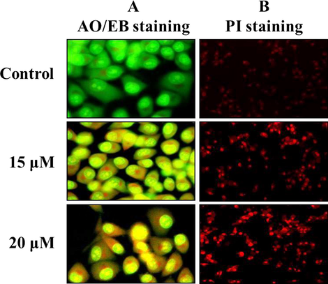 Effect of synthesized ZnO-Pip-NC scaffold on DNA damage and cell necrosis in the AGS cells. Fig. 9 revealed that the control cells were displayed the AO stained green fluorescence; surprisingly the ZnO-Pip-NC supplemented AGS cells were demonstrating the intense EtBr stained orange fluorescence that conforms the severe DNA damage. The PI stained AGS cells revealed that the ZnO-Pip-NC has stimulated the apoptosis in gastric cancer (AGS) cells.