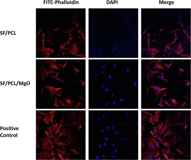 Confocal fluorescence microscopy observation of pre-osteoblasts on the electrospun membranes.