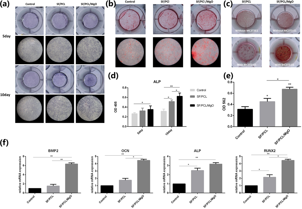 In vitro osteogenesis capability of the electrospun membranes. (a) ALP staining of MC3T3-E1 cells incubated with the extract from the SF/PCL and SF/PCL/MgO membranes after 5 and 10 days of osteoinduction. (b) Alizarin red S staining of MC3T3-E1 cells cultured with the extract from the SF/PCL and SF/PCL/MgO membranes. (c) Alizarin red S staining of the SF/PCL and SF/PCL/MgO membrane with or without MC3T3-E1 cell incubation. (d) Quantification of ALP activity. (e) Quantitative analysis of mineralisation nodes. (f) Expression of osteogenic genes BMP2, OCN, ALP and RUNX2 in MC3T3-E1 cells cultured with or without the extract of the SF/PCL and SF/PCL/MgO membranes for 21 days of osteoinduction. * p < 0.05, **p < 0.01.