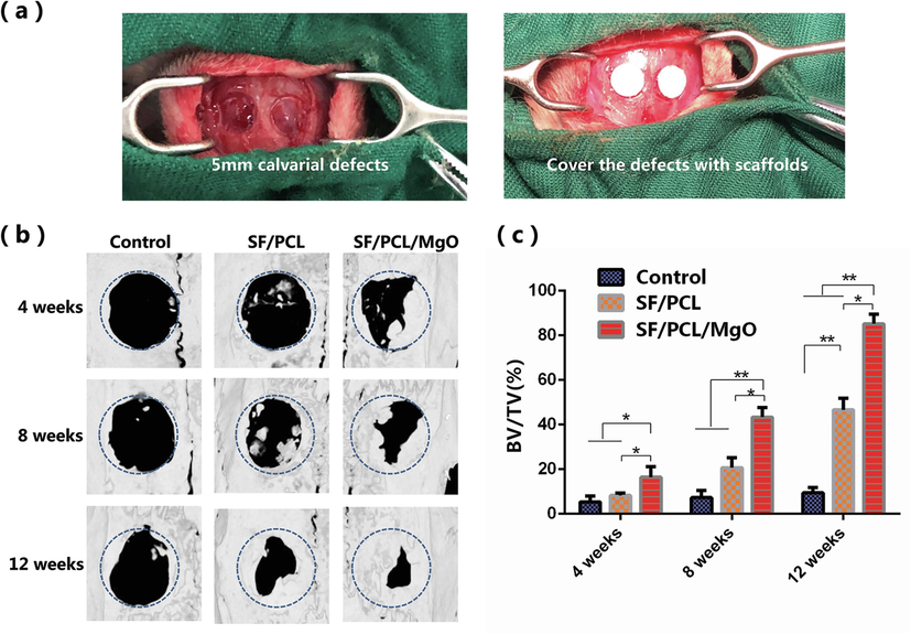 In vivo radiologic examination of bone regeneration at rat calvaria defects. (a) Optical image of the rat calvarial defects (b) Reconstructed 3D micro-CT images of the rat calvaria defects implanted with SF/PCL and SF/PCL/MgO membranes. (c) Quantitative analysis of the regenerated bone in values of BV/TV for the SF/PCL, SF/PCL/MgO and control groups. * p < 0.05, **p < 0.01.
