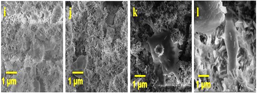 (A) and HAP/BA/CMC composites; (ii) cell viability of HAP (A) and HAP/BA/CMC composites and (iii) Optical image of cell viability for 1, 7 and 14 days of HAP (b, c and d).