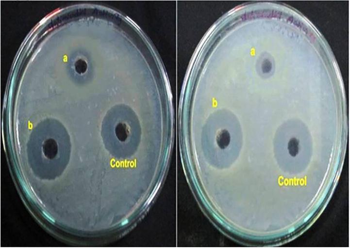 HAP/BA/CMC composites (f, g and h) respectively, image j, k and l is SEM image of cell adhesion on HAP/BA/CMC composites (a, e and J is control).