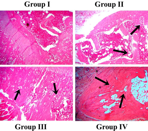 Effect of synthesized RR-CuONPs on histological analysis of hind limb of arthritic animals. The control animals showed normal cellular arrangements and tissue architecture. Conversely, the distinct signs of synovial hyperplasia, inflammatory cell infiltration, pannus formation, and joints and cartilage damages were noted in the CFA-challenged arthritic animals. The treatment with the RR-CuONPs showed an amazing protective activity and it prevented the cartilages, synovial and bone joint damages.