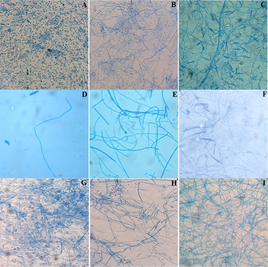 Microscopic observation of the dermatophyte treated with powder and extracts from C. althaeoides L. compared with negative growth control. A; T. rubrum negative control, B; T. mentagrophytes negative control, C; M. canis negative control, D; T. rubrum treated with powder, E; T. mentagrophytes treated with powder, F; M. canis treated with powder, G; T. rubrum treated with ethanol extract, H; T. mentagrophytes treated with ethanol extract, I; M. canis treated with ethanol extract.